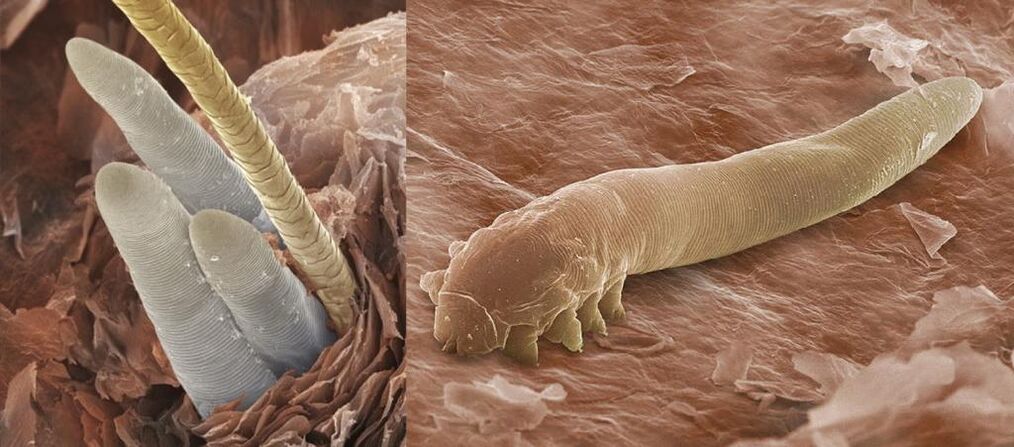 Ectoparsites