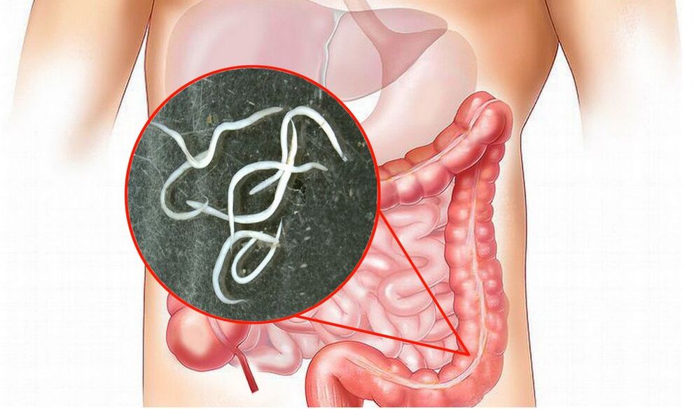 vermes nos intestinos