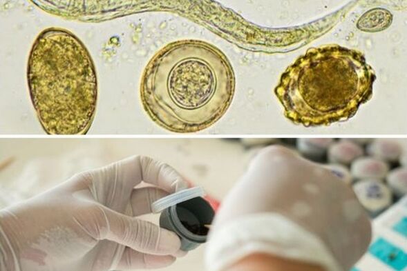 diagnóstico da presenza de parasitos no corpo