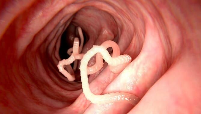 Vermes que viven nos intestinos humanos