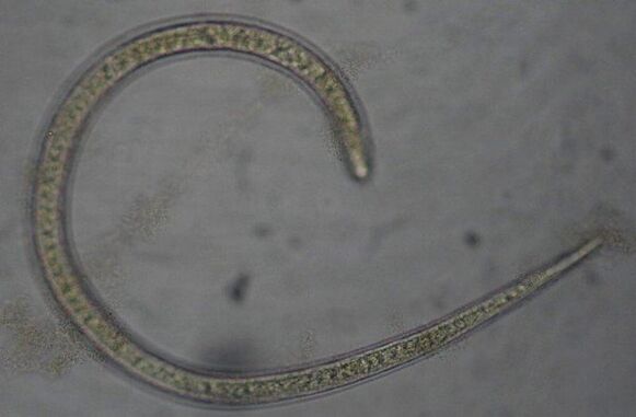 Trichinella é un verme parasitario redondo protóstomo