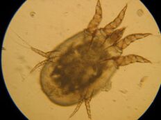 Marca baixo un microscopio