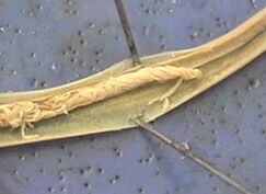 parasito